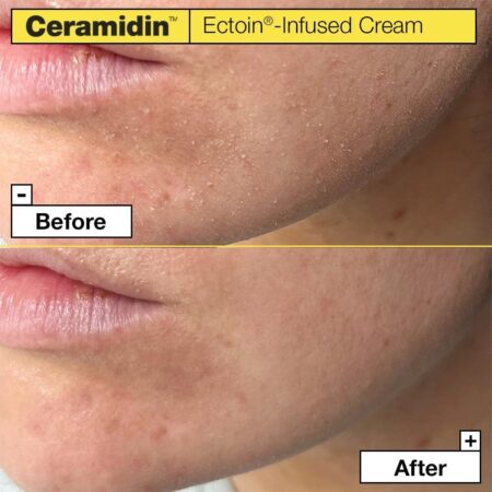 Ceramidin Ectoin-Infused Cream 50ml