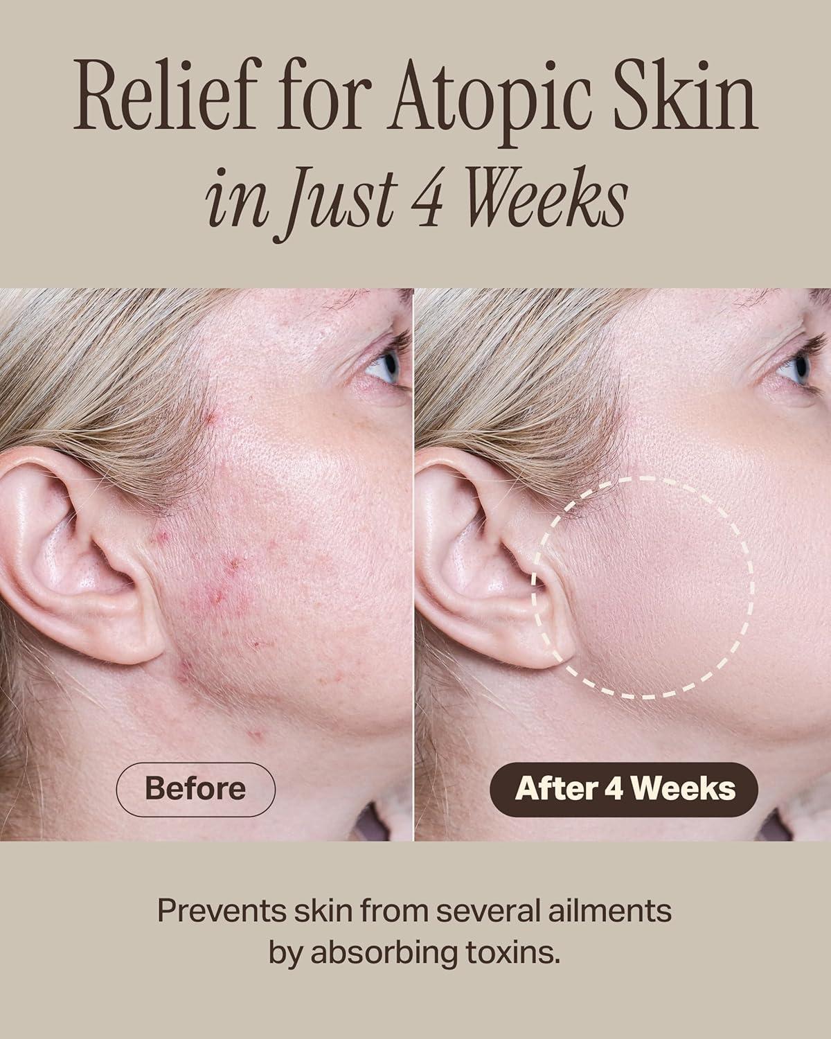 Recovery Mud Mask 110ml - Image 8